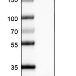 Atlas Antibodies Anti-PRL Antibody