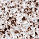 Atlas Antibodies Anti-PRL Antibody
