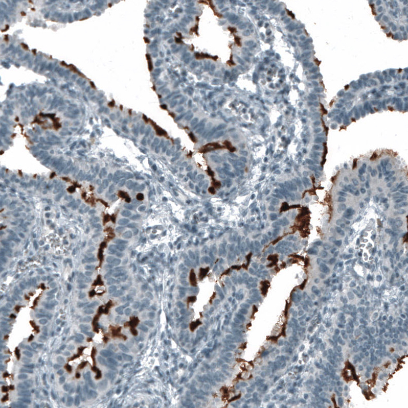 Atlas Antibodies Anti-PROM1 Antibody