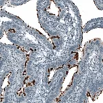 Atlas Antibodies Anti-PROM1 Antibody