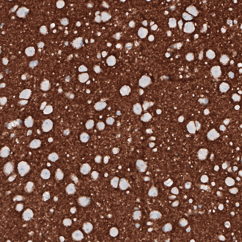 Atlas Antibodies Anti-PRRT2 Antibody