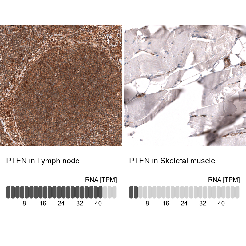 Atlas Antibodies Anti-PTEN Antibody