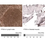 Atlas Antibodies Anti-PTEN Antibody