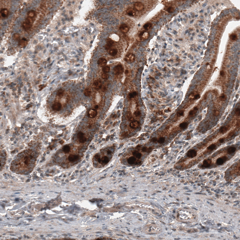 Atlas Antibodies Anti-RBCK1 Antibody