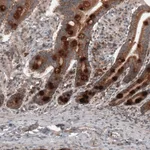 Atlas Antibodies Anti-RBCK1 Antibody