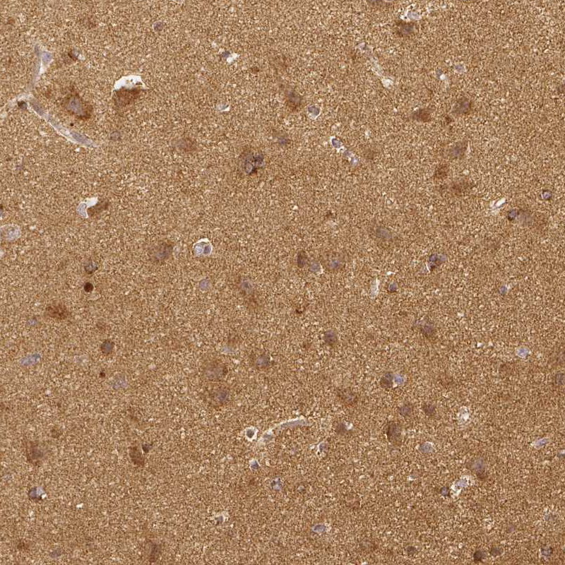 Atlas Antibodies Anti-RHOT1 Antibody