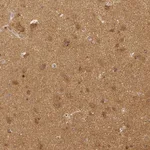 Atlas Antibodies Anti-RHOT1 Antibody