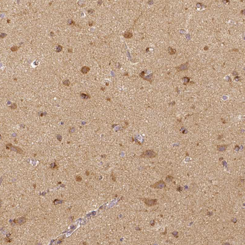 Atlas Antibodies Anti-RHOT1 Antibody