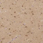 Atlas Antibodies Anti-RHOT1 Antibody
