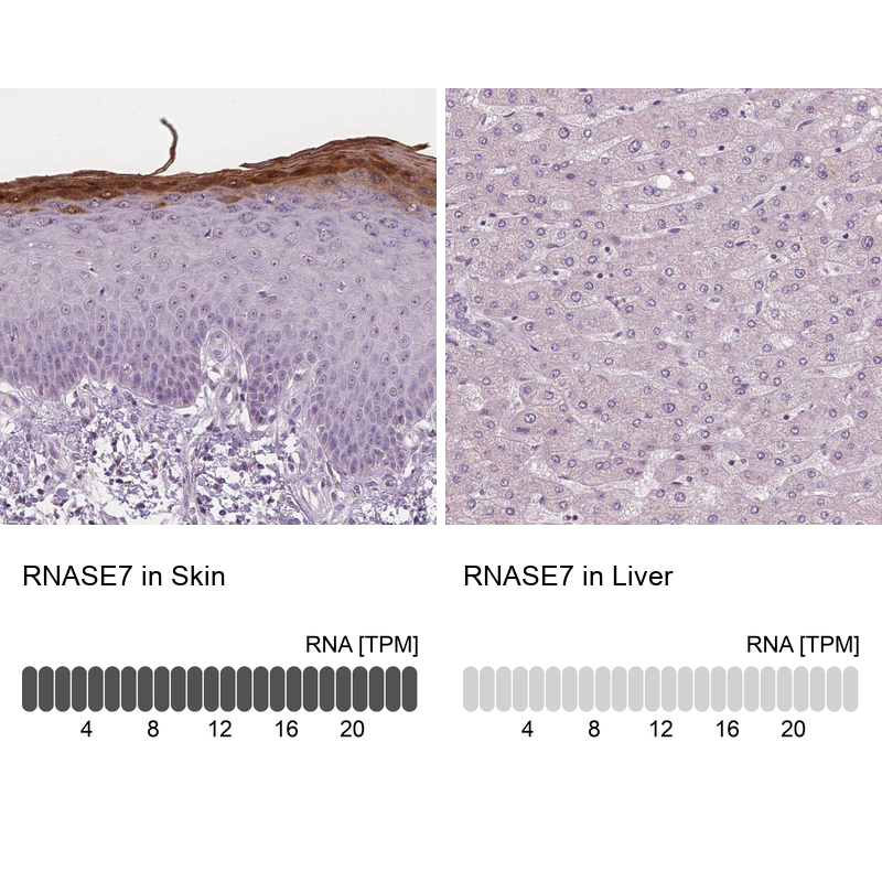 Atlas Antibodies Anti-RNASE7 Antibody