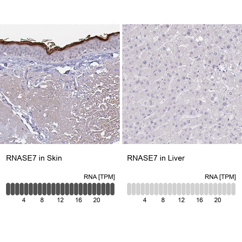 Atlas Antibodies Anti-RNASE7 Antibody