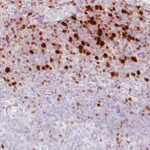 Atlas Antibodies Anti-RUNX2 Antibody