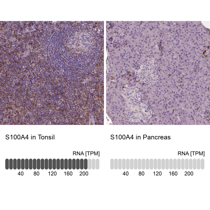 Atlas Antibodies Anti-S100A4 Antibody