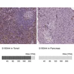 Atlas Antibodies Anti-S100A4 Antibody