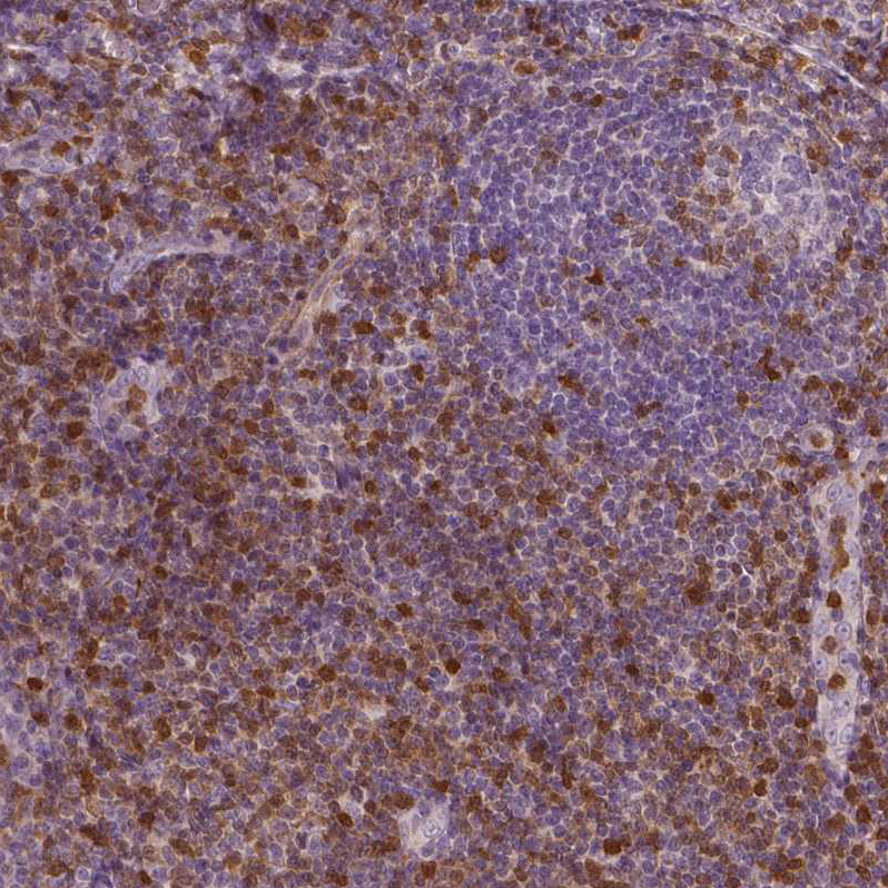 Atlas Antibodies Anti-S100A4 Antibody