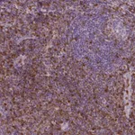 Atlas Antibodies Anti-S100A4 Antibody