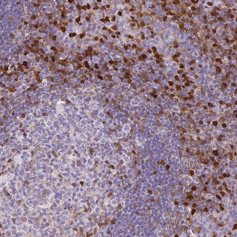 Atlas Antibodies Anti-S100A4 Antibody