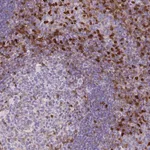 Atlas Antibodies Anti-S100A4 Antibody