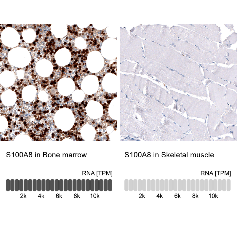Atlas Antibodies Anti-S100A8 Antibody