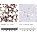 Atlas Antibodies Anti-S100A8 Antibody