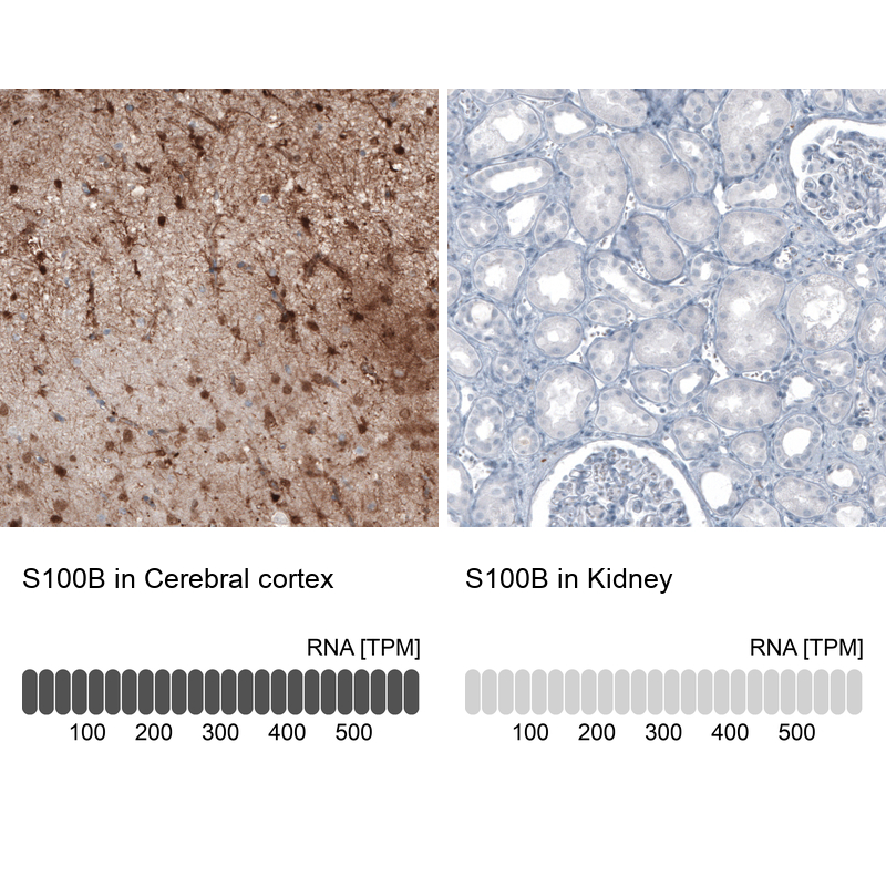 Atlas Antibodies Anti-S100B Antibody