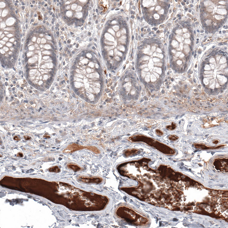 Atlas Antibodies Anti-SAA1 Antibody