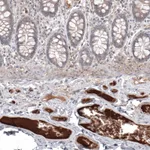 Atlas Antibodies Anti-SAA1 Antibody