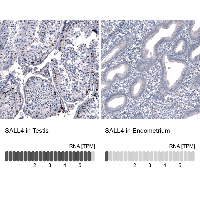 Atlas Antibodies Anti-SALL4 Antibody