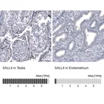 Atlas Antibodies Anti-SALL4 Antibody