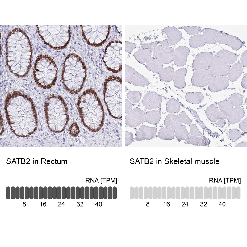 Atlas Antibodies Anti-SATB2 Antibody