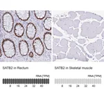 Atlas Antibodies Anti-SATB2 Antibody