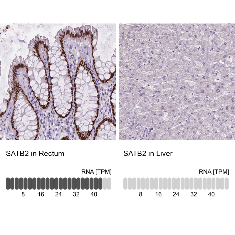 Atlas Antibodies Anti-SATB2 Antibody