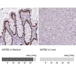 Atlas Antibodies Anti-SATB2 Antibody