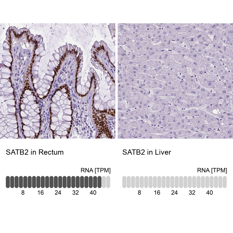 Atlas Antibodies Anti-SATB2 Antibody