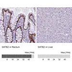 Atlas Antibodies Anti-SATB2 Antibody