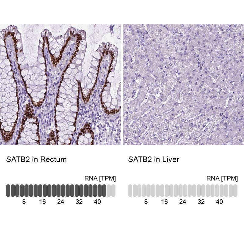 Atlas Antibodies Anti-SATB2 Antibody