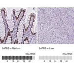 Atlas Antibodies Anti-SATB2 Antibody