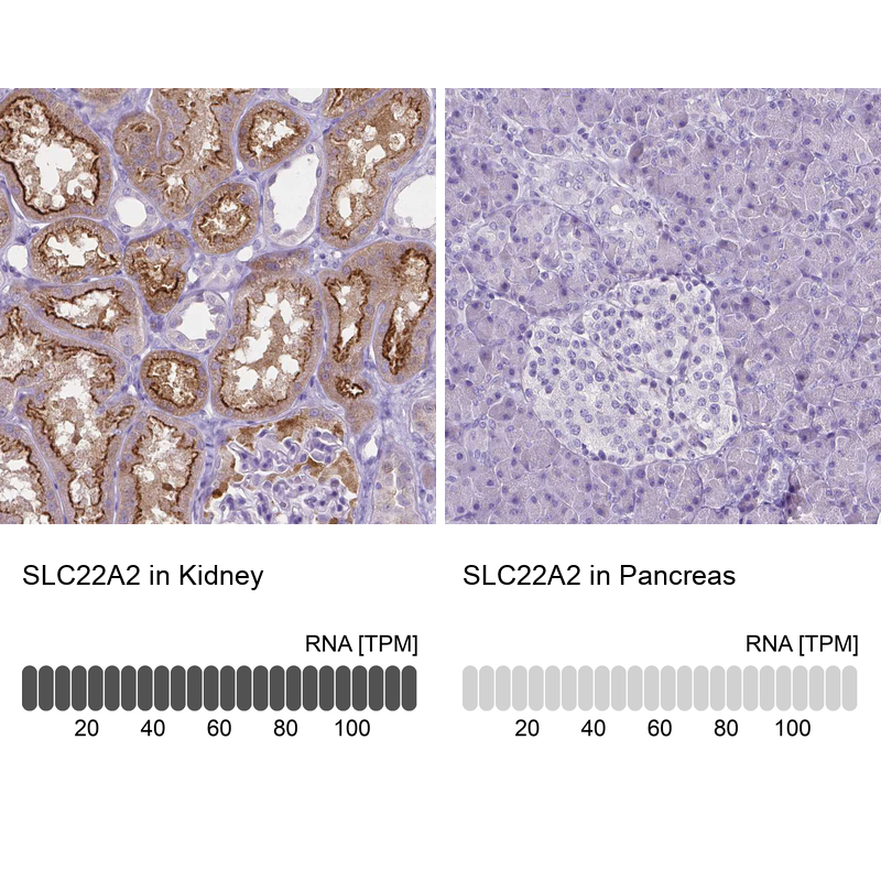 Atlas Antibodies Anti-SLC22A2 Antibody