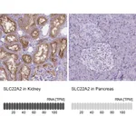 Atlas Antibodies Anti-SLC22A2 Antibody
