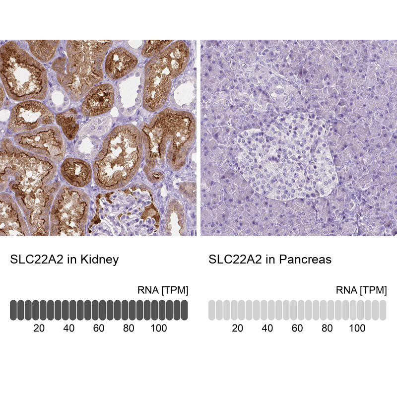 Atlas Antibodies Anti-SLC22A2 Antibody