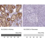 Atlas Antibodies Anti-SLC22A2 Antibody