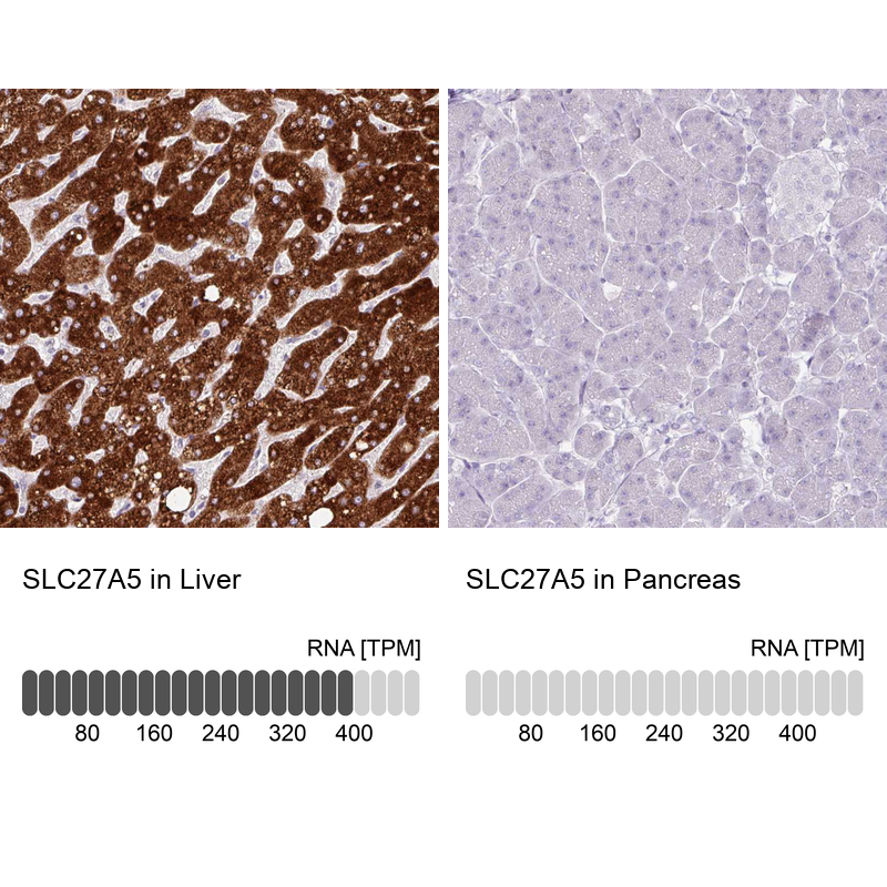 Atlas Antibodies Anti-SLC27A5 Antibody