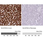 Atlas Antibodies Anti-SLC27A5 Antibody