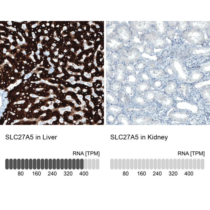 Atlas Antibodies Anti-SLC27A5 Antibody