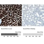 Atlas Antibodies Anti-SLC27A5 Antibody