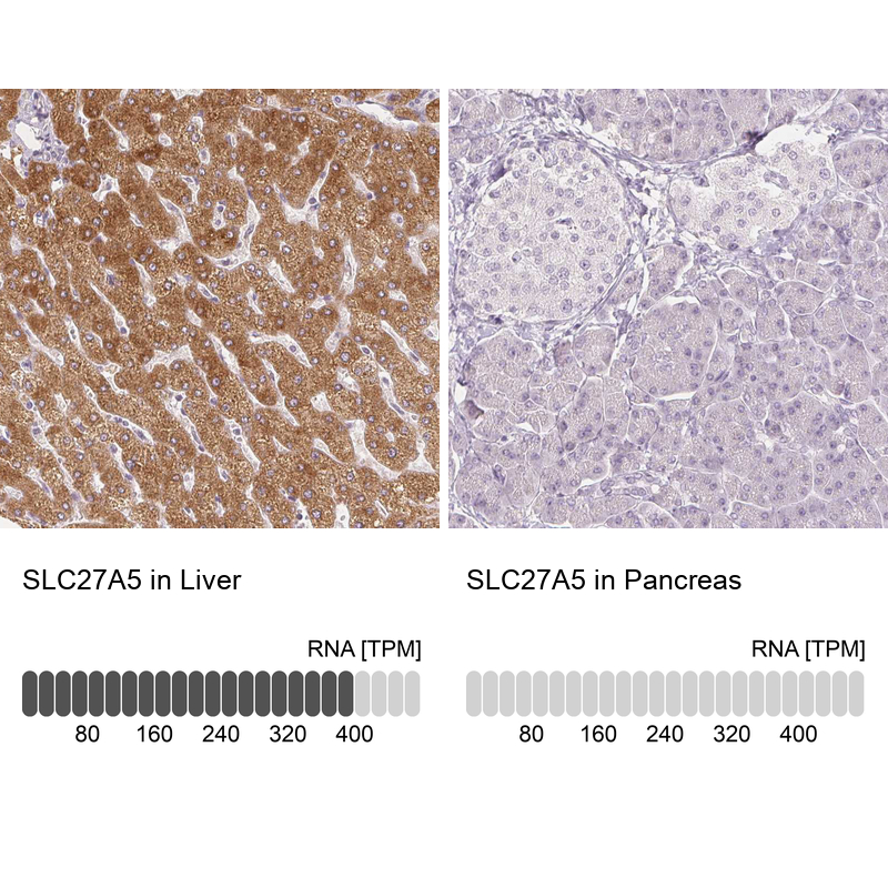 Atlas Antibodies Anti-SLC27A5 Antibody