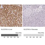 Atlas Antibodies Anti-SLC27A5 Antibody