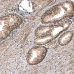 Atlas Antibodies Anti-SMAD4 Antibody