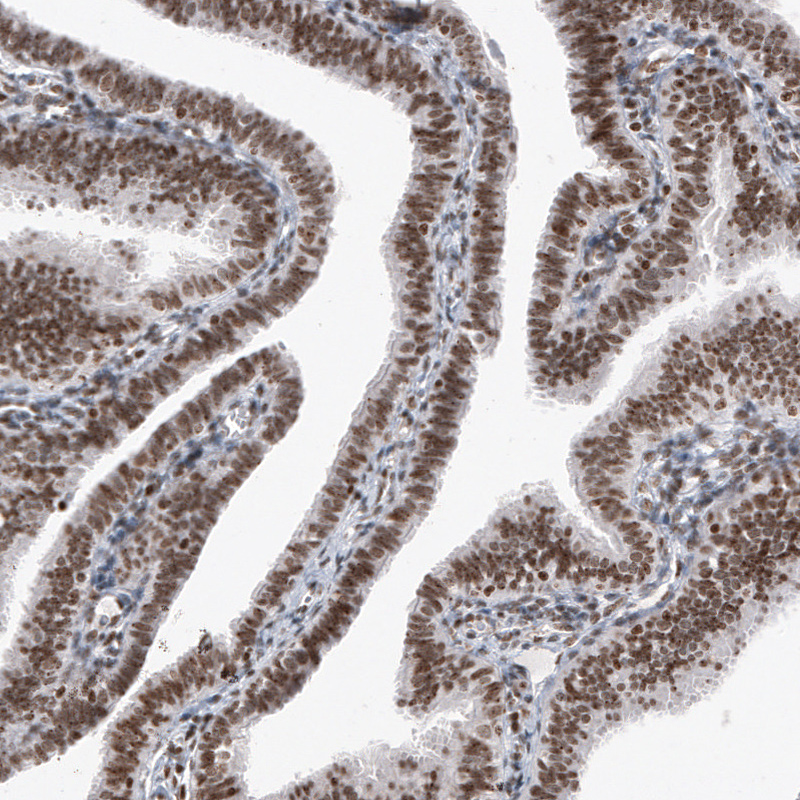 Atlas Antibodies Anti-SMCHD1 Antibody
