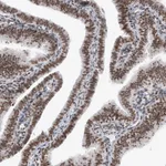Atlas Antibodies Anti-SMCHD1 Antibody